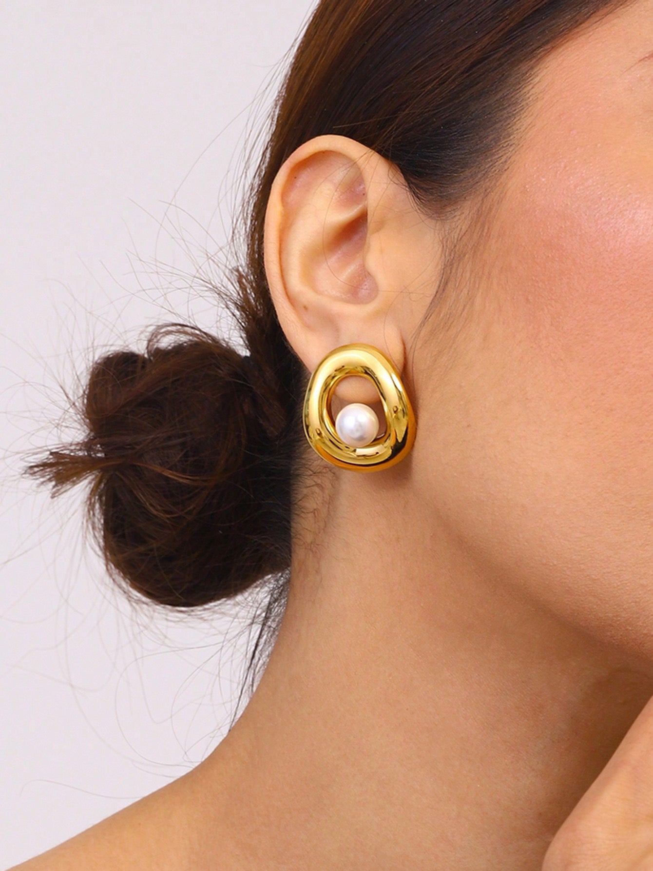 9911-Aretes